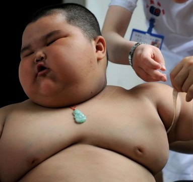 Les raisons de l’obésité infantile rurale par China Comment