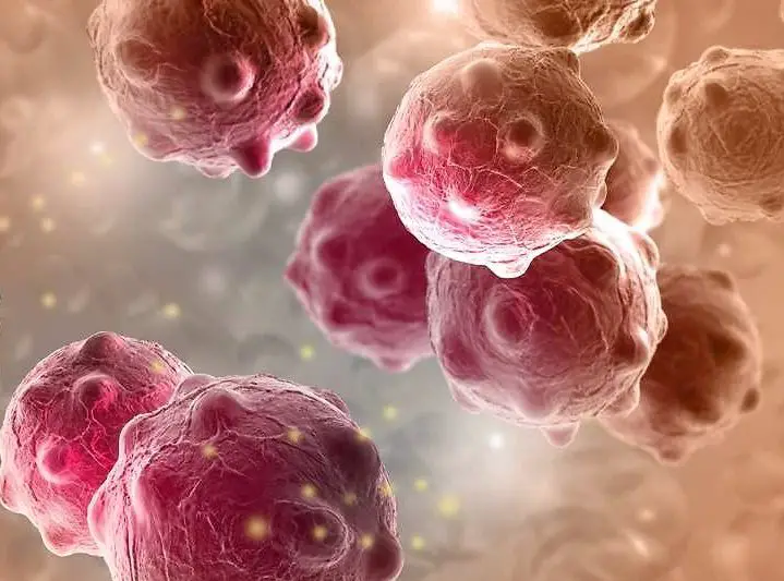 Chi-Med va bientôt lancé un anticancéreux